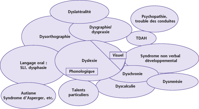 Rapport SFO 2017 - OPHTALMOLOGIE PÉDIATRIQUE