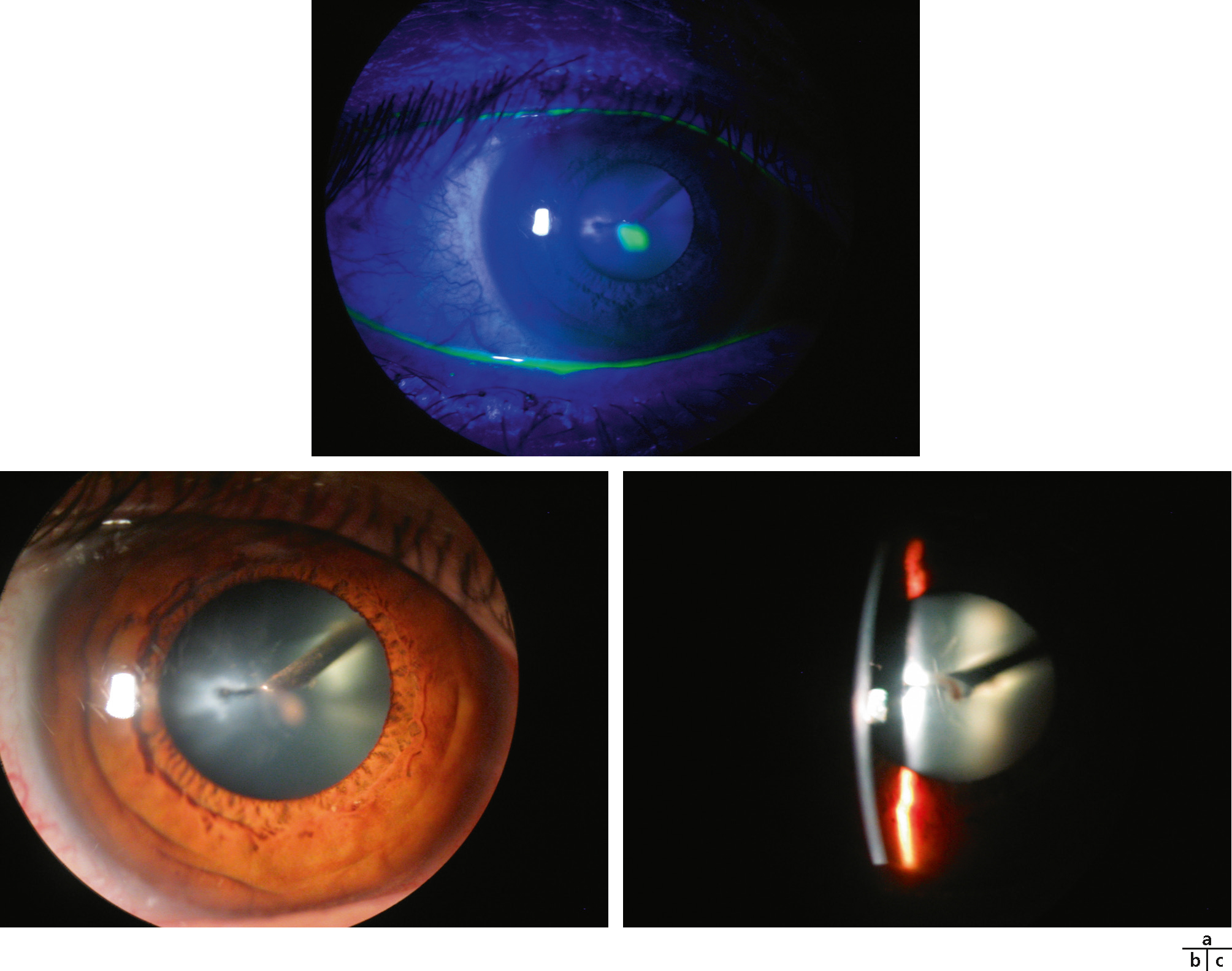 Rapport SFO 2018 - URGENCES EN OPHTALMOLOGIE