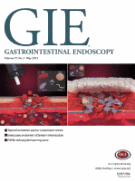 Unusual intussusception within a hiatal hernia sac, reduced