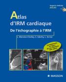 Atlas d'imagerie cardiaque 